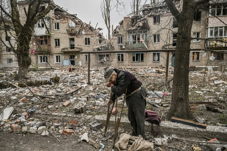 A person in crutches wipes their face with their hand as they stand amid debris and near a building destroyed by bombardment.